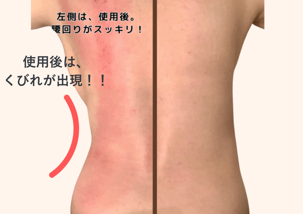 痩身だけじゃない!巡りを整えるクラッシュ吸引の魅力☆ 痩身だけじゃない!巡りを整えるクラッシュ吸引の魅力☆