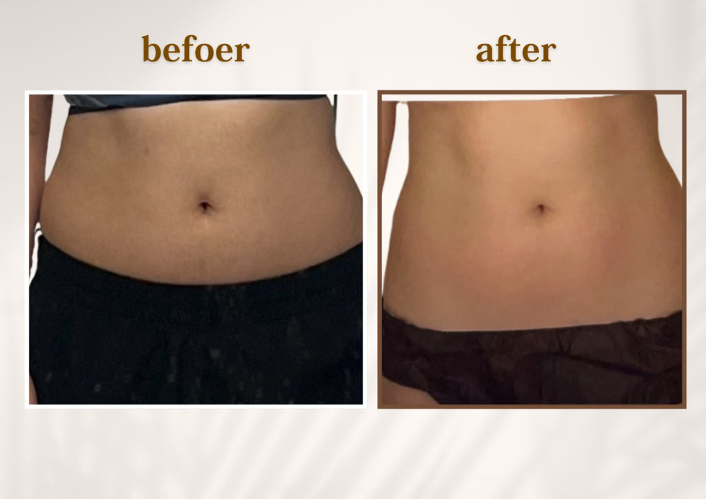 年々落ちない下腹、原因から変えるお腹痩身