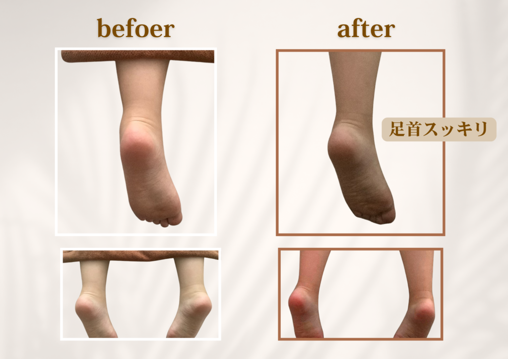 足首が太くなる原因とは？むくみ・巡りに着目した脚ケア