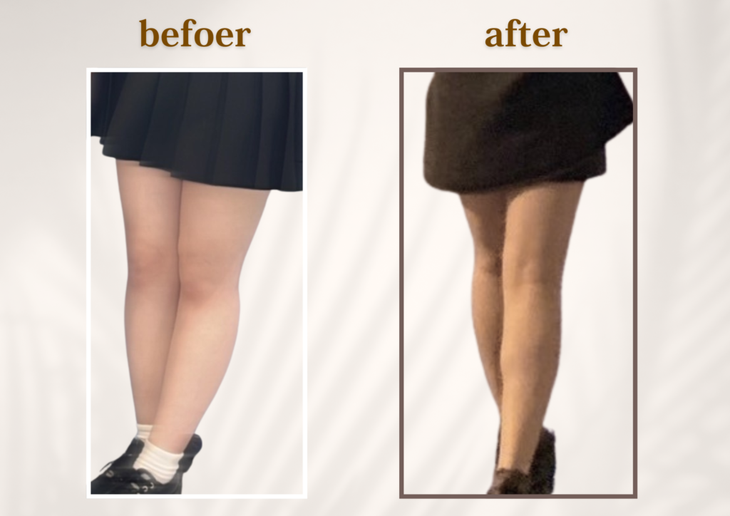 【乃木坂の脚痩せ】他撮りに自信が持てる美脚リンパ痩身