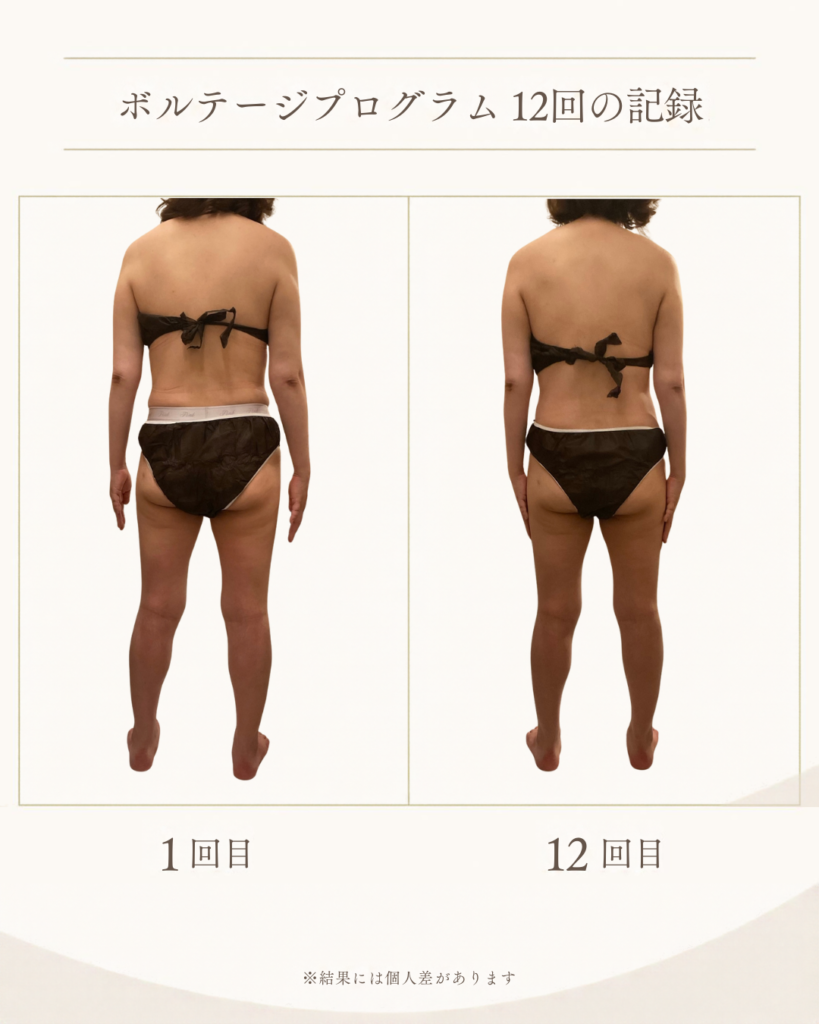 上野・湯島でリバウンド卒業！痩身リンパ×ジムが定額サブスクに